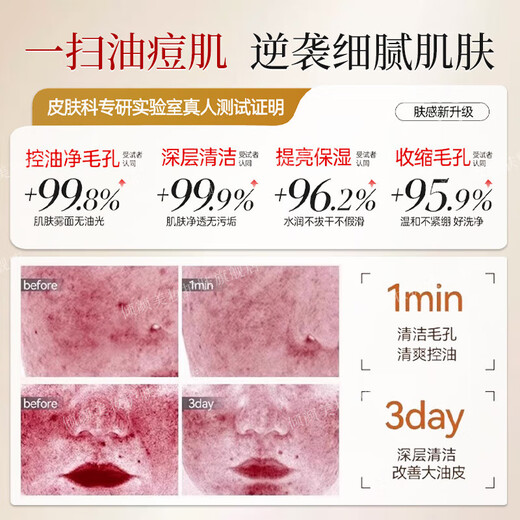 倾龄硫磺洗面奶深层清洁毛孔控油除螨沐浴露去黑头祛痘净颜男士洁面乳 三支装更实惠【清洁黑头粉刺闭口】