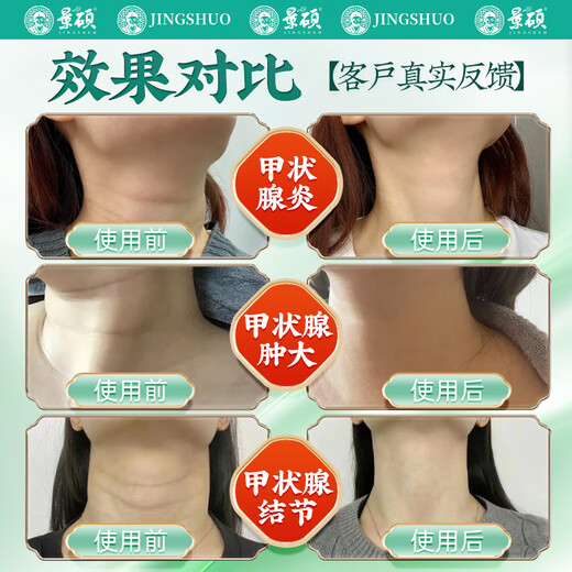 
Jingshuo Dandelion Herb Qingsan Tea Dandelion Root Green Money Cassia Cassia Pueraria Licorice Men and Women Three Boxes 600g