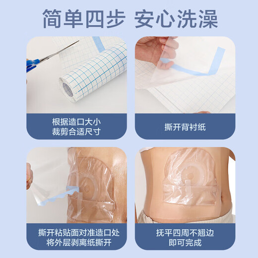 Coloplast Stomia Bath Patch Care Products Protection des plaies après chirurgie Film étanche Natation transparente 2 20 cm * 5m / rouleau + 5009 Poche de stomie * 1 comprimé