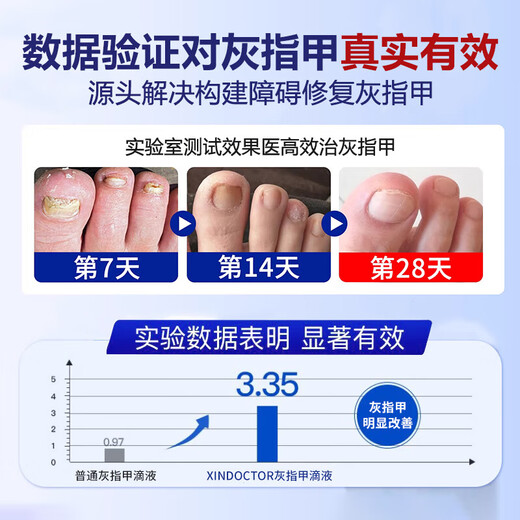 Hong Kong Pharmacy Co., Ltd. special onychomycosis removal, thickening, yellowing and emptying of onychomycosis, suitable for onychomycosis, Chinese herbal water antibacterial solution 30ml