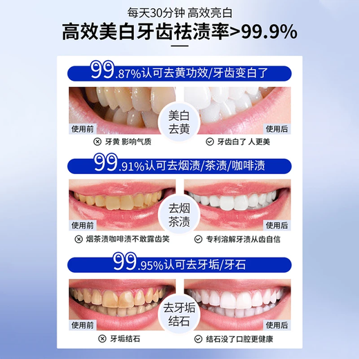 爱兰歌娜美白牙贴白牙去黄去渍清新口气异味去口腔臭洁白美牙神器官方正品 【两盒更优惠】 28片*2盒