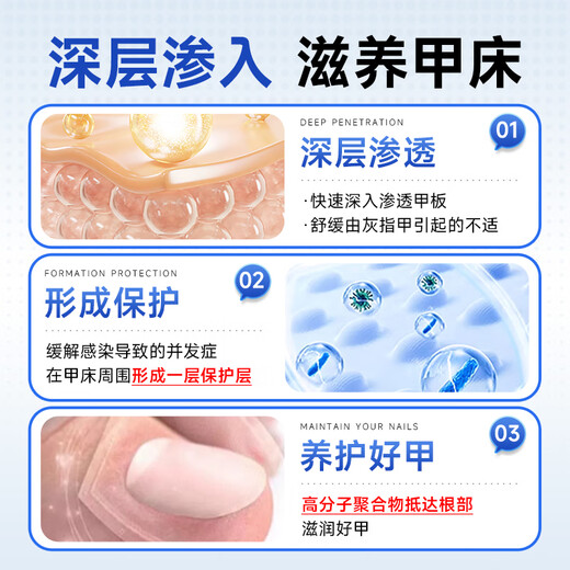 Hong Kong Pharmacy Co., Ltd. special onychomycosis removal, thickening, yellowing and emptying of onychomycosis, suitable for onychomycosis, Chinese herbal water antibacterial solution 30ml