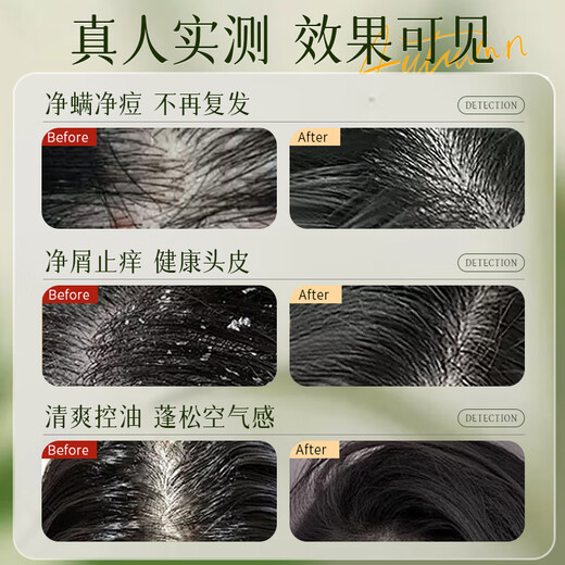 
HIEUAILR imported raw materials shampoo, anti-dandruff, anti-itchi, mites, acne control oil, lasting fragrance, fluffy, gold list for men and women [sweeping oil, mites, mites] 808ml*1