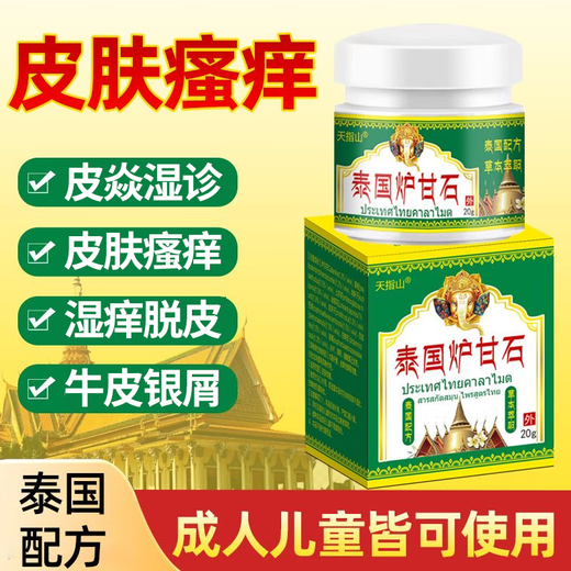 特康克（Teconk）【9737人收藏】进口炉甘石快速止痒皮肤干燥瘙痒外用全身干痒皮肤 单盒