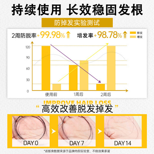 
OHBT ginger oil-controlled shampoo 500g, hair-controlled oil-controlled shampoo