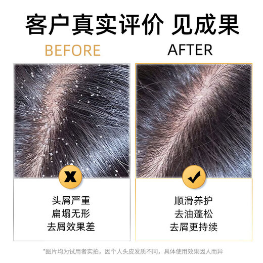 采乐去屑止痒洗发水控油持久蓬松洗发乳清爽柔顺留香洗头膏男女士同康 【旅行装】酮康去屑止痒 80ml*1瓶