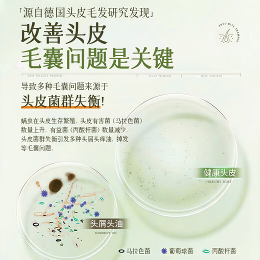 
HIEUAILR imported raw materials shampoo, anti-dandruff, anti-itchi, mites, acne control oil, lasting fragrance, fluffy, gold list for men and women [sweeping oil, mites, mites] 808ml*1