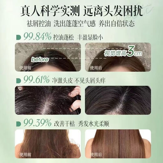 Fan Yongchen Pang Donglai Shampooing Contrôle de l'huile Contrôle du shampooing moelleux et anti-dandroffes moelleux pour enfants, hommes et femmes 820 ml