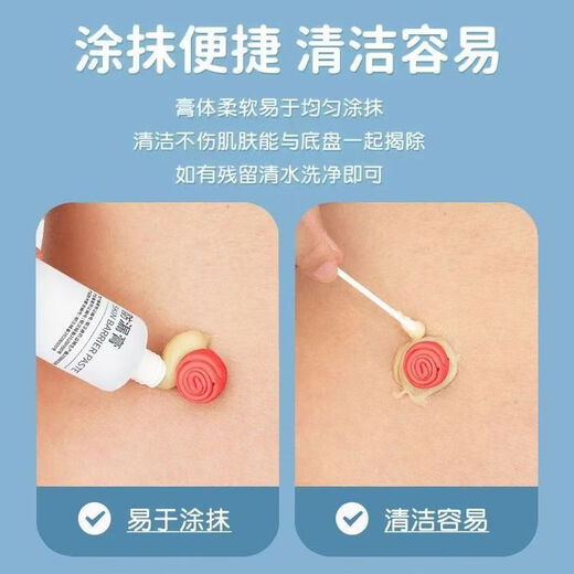 Kanglebao-Stoma-Leck-Sof-Paste ohne Alkohol Leckage Kleber Füllung Das Fistel Gap Stoma-Chassis ersetzt Leckage-Sof-Patch-Ring 12050 Gleiches Modell [Inland Ersatz Kanglebao] Stoma-Leck-Soach-Paste [1 Box] Erfahrungspaket