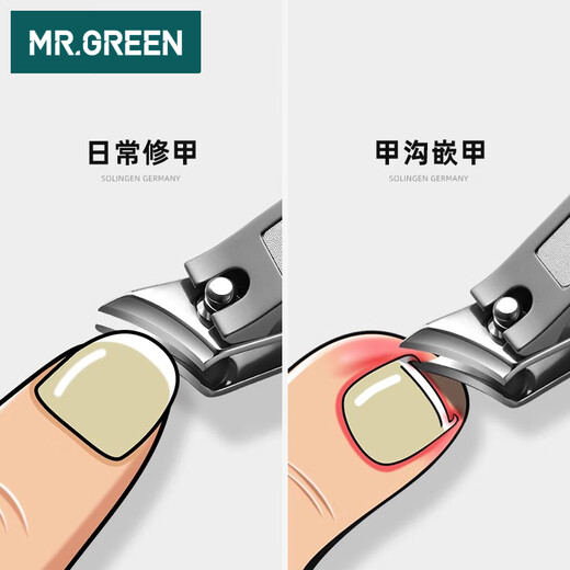 MR.GREEN德国斜口指甲刀甲沟炎专用指甲钳修脚灰甲嵌甲剪进口2件套Mr-9201