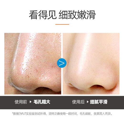 FUT Clear Cohe -head Repose Blackhead Export Export Liquid rétrécissement Pores Large Clean fermé Acné T-zone combinaison hommes et femmes claires