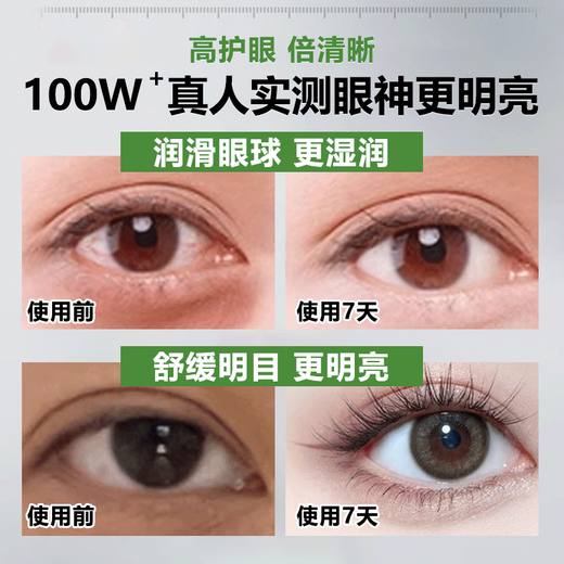 BEAI叶黄素护眼喷雾洗眼液医用抗菌缓解眼疲劳瘙痒干涩视力模糊100ml