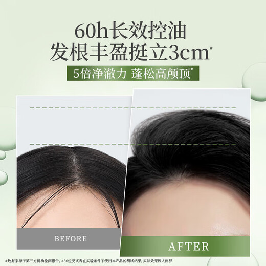 滋源无患子控油清爽洗发水洗发露去屑止痒无硅油强根蓬松男女士洗头膏 控油清爽洗发水265ml+470+120