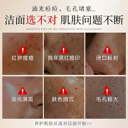 Cleanser facial Drar Sulphur, embellecer, limpieza suave, limpieza de suero, Blackhead encoge los poros y controla el aceite para hombres y mujeres 2 botellas [limpieza diaria y control del aceite]