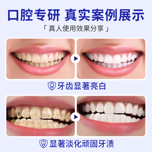 
Jiafuni Toothpaste Cleansing Tooth Whitening Fresh Tooth Brightening Tooth Men and Women Jiafuni Toothpaste Plus Fresh Flagship Two Packages*240g