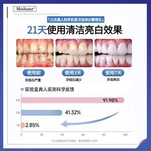 Moihanr胖东来美白牙膏去口臭去黄去牙渍去烟渍牙垢十大知名品牌含氟护龈