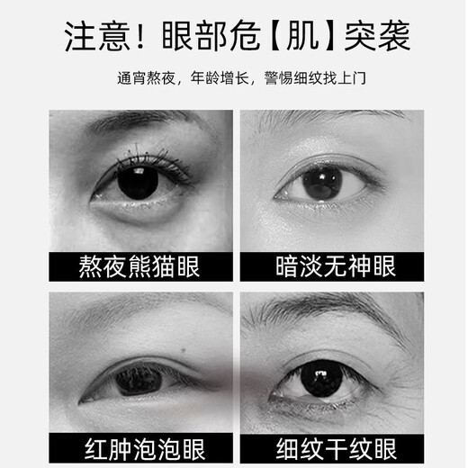 Seidenvorhang Augenbeutel Entfernung Artefakt schwerwiegende Probleme mit Augenbeutel mittleren Alters und älteren Männer und Frauen Viper Peptid Eye Cream Dark Eye Circle Schwere Augenbeutel 3 Flaschen [Verwendung für mäßige Augenbeutel Lose Gebrauch]
