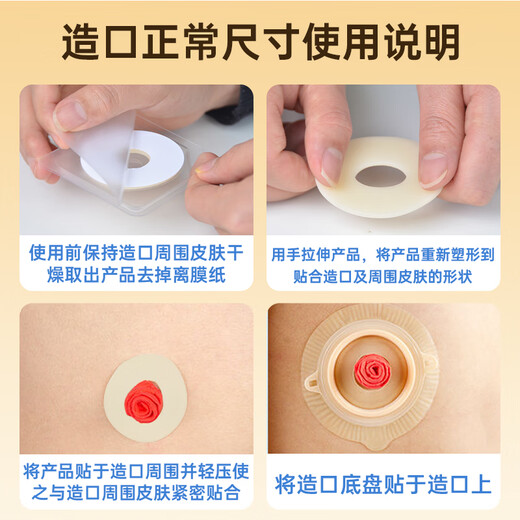 护士同学造口防漏圈12035同款可塑贴环底盘防漏贴密封弹力胶造口护理用品 【10个/盒】4.2mm12045