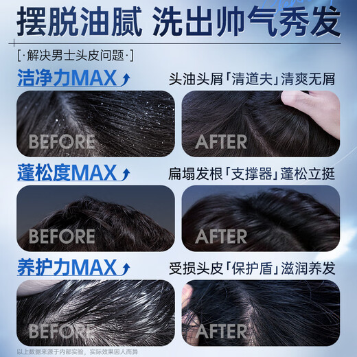 Koreanische Getreide Männer Special Silicon-freies Shampoo Langzeitöl und flauschige Stützduft-Duft-Linderung itchy Anti-Dandruff-Shampoo Goldliste