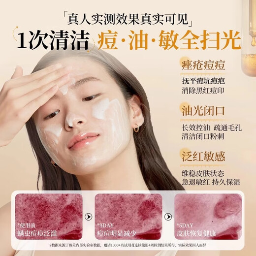 Cleanser facial Drar Sulphur, embellecer, limpieza suave, limpieza de suero, Blackhead encoge los poros y controla el aceite para hombres y mujeres 2 botellas [limpieza diaria y control del aceite]
