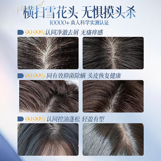 Lüfter Yongchen Selenium Disulfid Shampoo Shampoo Kontroll Ölreinigung Linderung Juckreizes Entfernen von Schuppen Haar glänzend Flush Erfrischend verbleibend duftend