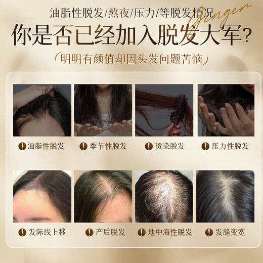南京同仁堂生姜洗发水防脱发育发固发养发增发密发去屑止痒控油脱发严重专用 1瓶装【14天止脱】