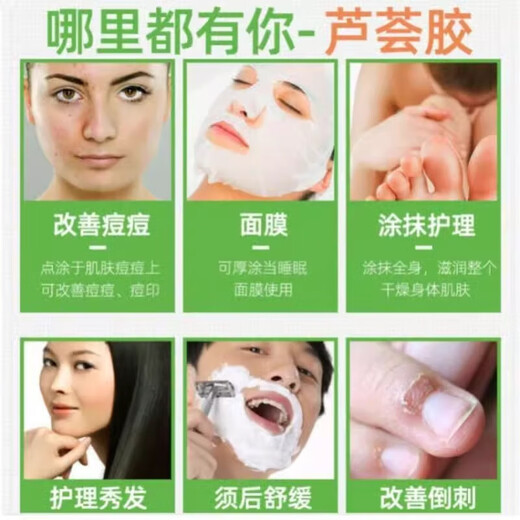 Beauty salon special spa tool skin irrigation set aloe vera gel hydrating moisturizing after sun repair acne scars 300g bottle of aloe vera gel