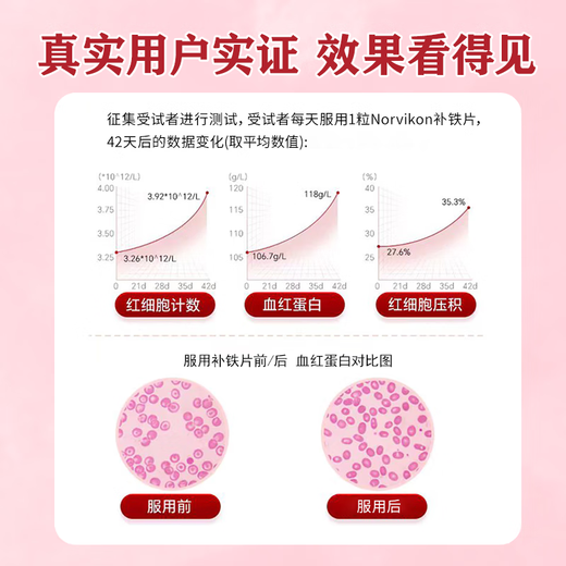 norvikon美国进口补铁富铁软糖孕妇补铁补血改善贫血90粒