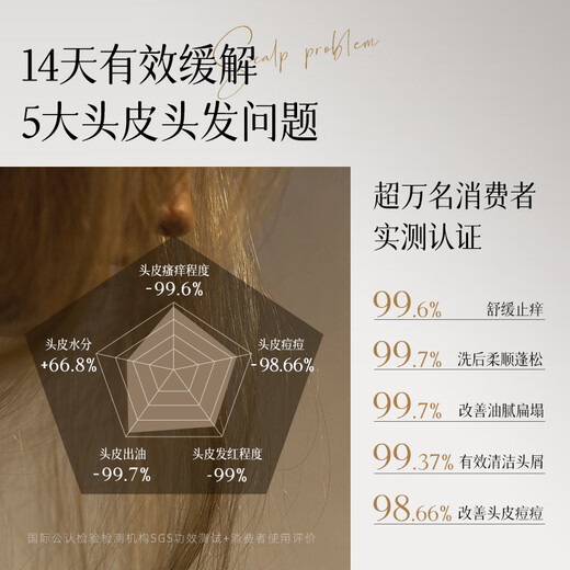 Allowish folliculitis shampoo 300ml anti-dandruff anti-itching oil control long-lasting fluffy anti-hair loss shampoo imported