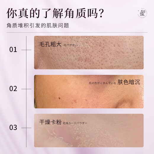 Eleytele Япония импортирует отшелушивающий гель, очищающее средство для лица для удаления черных точек, сужения пор, глубокой очистки для мужчин и женщин, отшелушивающий гель 100 мл/флакон