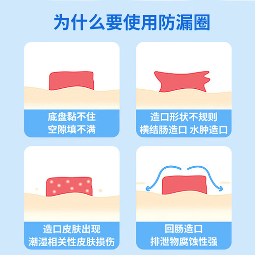 康宝乐造口防漏贴环12030可塑防漏圈医用造瘘口护理密封贴环平替康乐保 【4MM厚】K12042防漏贴环10个/盒