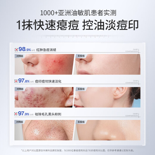 华美科 HURMEVKOR壬二酸凝胶20%医壬二酸凝胶祛痘凝露淡化痘印痘坑去水杨酸1支