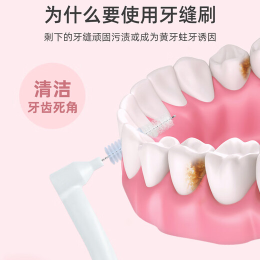Xiaolu Mama L-shaped interdental brushing gap brush 0.7mm 20 orthodontic correction teeth ultrafine interdental brush brush fine brush head