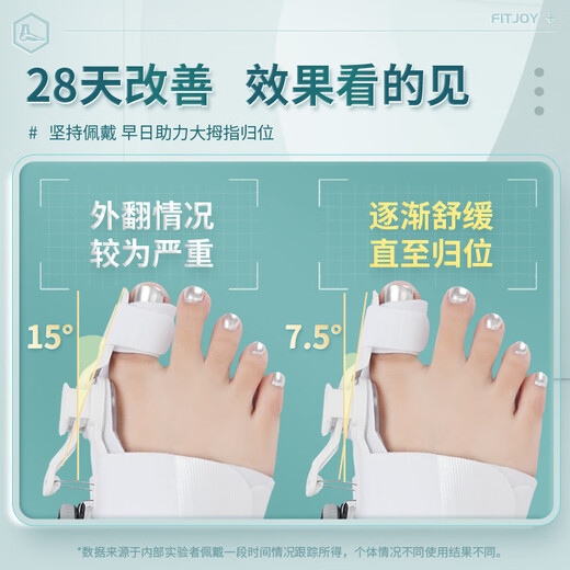 1098人好评脚趾器可调节旋钮拇指外翻分趾器男女大脚骨纠正效 旗舰全新旋钮调节36-44码一