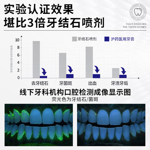 Shanghai pharmaceutical medical tartar toothpaste-like antibacterial and bad breath remove yellowing remove tooth stains remove cigarette stains tartar anti-desensitization and teeth clean