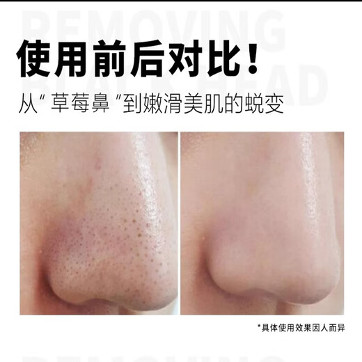 MdoC Powerful Blackhead and Acne Remover Closed Mouth Peel-off Mask to Shrink Pores 100g Birthday Gift for Girls MdoC Powerful Blackhead and Acne Remover Closed Mouth Peel-off Mask to Shrink Pores 100g Birthday Gift for Girls