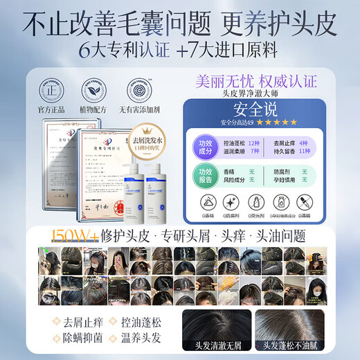 Lüfter Yongchen Selenium Disulfid Shampoo Shampoo Kontroll Ölreinigung Linderung Juckreizes Entfernen von Schuppen Haar glänzend Flush Erfrischend verbleibend duftend