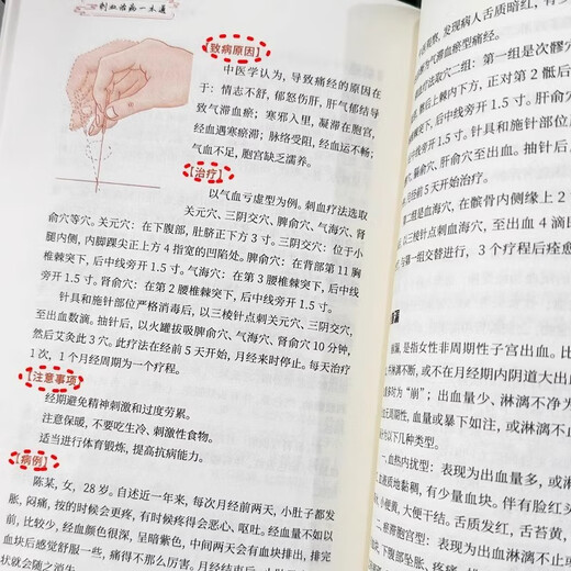 [Book Jingpin] Xinhua authentique médecine chinoise, piqûres de sang et maladies de durcissement, SN3294 N3294