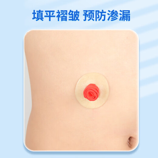 康宝乐造口防漏贴环12030可塑防漏圈医用造瘘口护理密封贴环平替康乐保 【4MM厚】K12042防漏贴环10个/盒