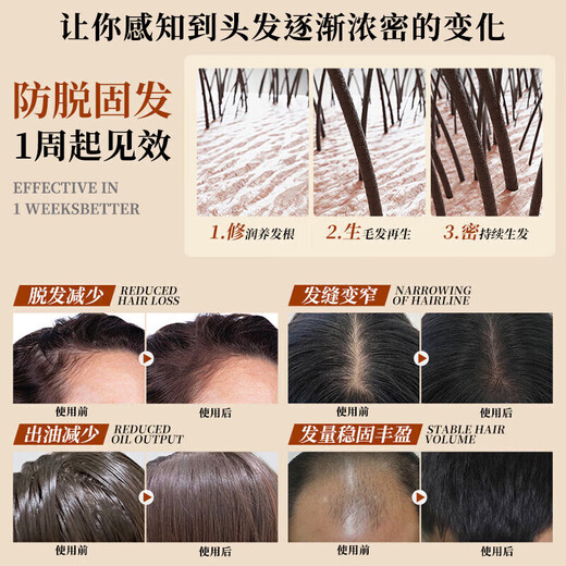 南京同仁堂生姜洗发水防脱发育发固发养发增发密发去屑止痒控油脱发严重专用 1瓶装【14天止脱】