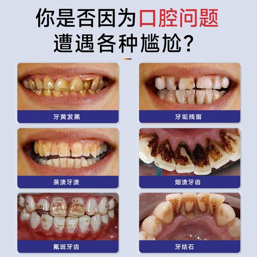 Moihanr胖东来美白牙膏去口臭去黄去牙渍去烟渍牙垢十大知名品牌含氟护龈