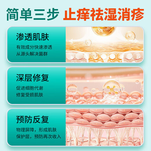 Tongrentang eczema anti-itch skin itching body itching anti-itch dermatitis eczema fungus scrotum moist thigh itching spray cream