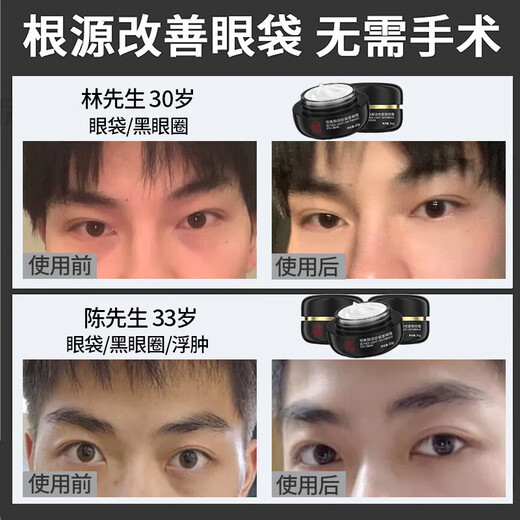 同仁堂a醇眼大袋消除男士去眼大袋眼霜淡化细纹提拉紧致黑大眼圈眼霜