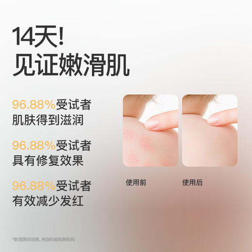 Sakose Children's Vaseline Calendula Body Lotion 500ml Autumn and Winter Moisturizing Moisturizing Dry Skin Infants and Young Children