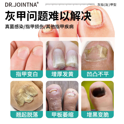DR.JOINTNA Pharmaceutical onychomycosis special nail fungal infection denaturation and bad nail yellowing and thickening special effect nail artifact liquid phoenix flower