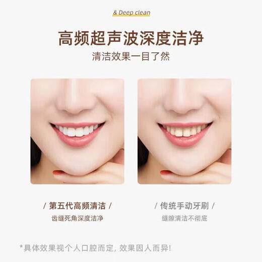 Elektrische Zahnbürste für Erwachsene, weiche Borsten, Zahnfleischschutz-Zahnbürste, minimalistischer Luxus, IPX7 wasserdicht, für den Haushalt, rosa, wiederaufladbar, tragbar, elektrische Zahnbürste