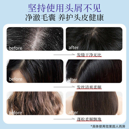 Lishikang sulfur shampoo anti-dandruff anti-oil control sulfur soap shampoo cream hair follicle seborrheic scalp teenager shampoo inflammation