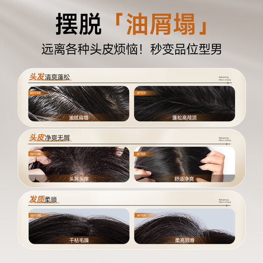 Zunlan Men's Gu Long Shampoo 400G-контролируемый нефтью против передачи анти-перенос