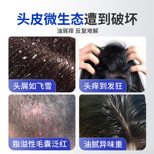 Lishikang sulfur shampoo anti-dandruff anti-oil control sulfur soap shampoo cream hair follicle seborrheic scalp teenager shampoo inflammation