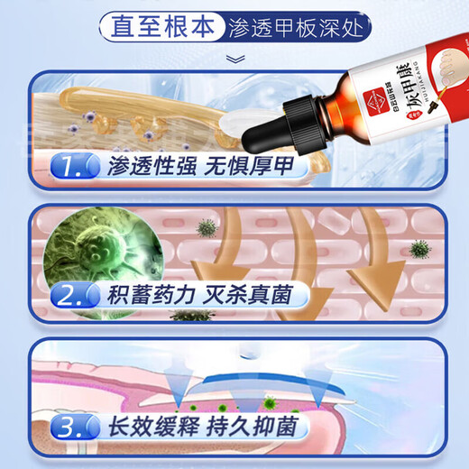 Baiyunshan Huacheng Onychomycosis 100% special effect medicine for nail fungal infection, removal of onychomycosis, thickening of onychomycosis, antibacterial potion, special effect 3 boxes, 90% selection, 2 get 1 free